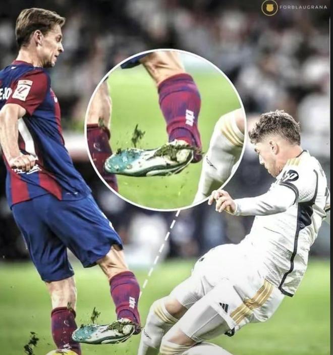 足球运动员受伤,需紧急处理伤痛 足球运动员受伤,需紧急处理伤痛